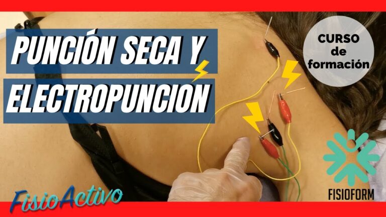 Servicios de Fisioterapia Deportiva en Belmonte